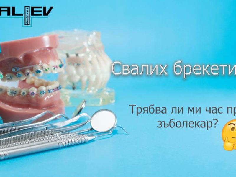 Свали ли брекетите?
