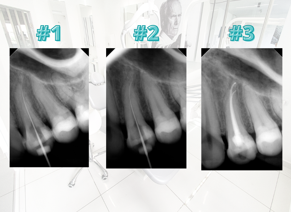 Кореново лечение, д-р Каролина Бачова, Saliev Dental Care София