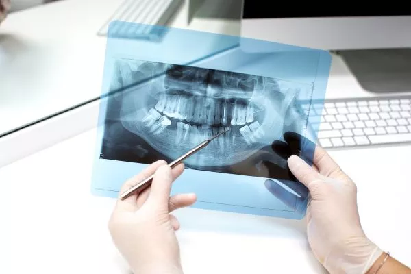 Рентгенова диагностика, Saliev Dental Care